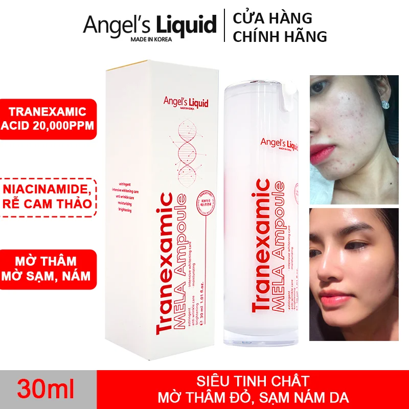 Tinh Chất Mờ Nám Chuyên Sâu Angel's Liquid Tranexamic Mela Ampoule (30ml) –  Bonita Cosmetic Shop